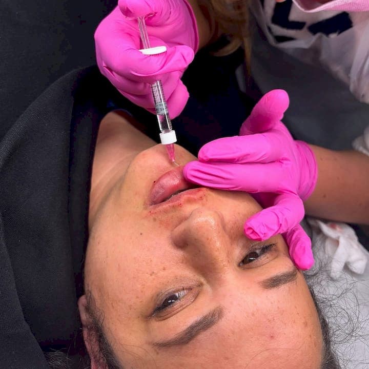 Streamline your injectables training workflow for success